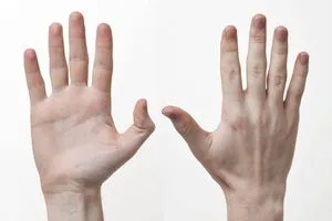 علامات في الجلد قد تدل اعلى إصابتك بهذه الأمراض