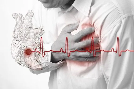 علامات الإصابة بالنوبة القلبية وخطوات الإسعاف الأولي