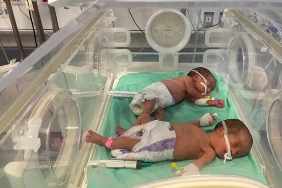 اليونيسيف رضع غزة يتشاركون أقنعة الأكسجين والأسرة بسبب الحصار الإسرائيلي