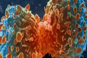 الكشف عن آلية جديدة تحفّز المناعة لعلاج سرطان البنكرياس وكالة الانباء العراقية واع