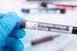 ماربورغ ظهور فيروس قاتل وتحذير أممي شفق نيوز