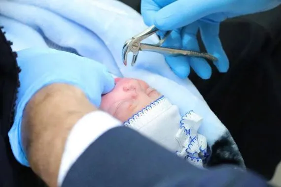 مولود جديد في العراق يفاجئ الأطباء بـ سن لبني شفق نيوز