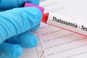 بينها تخص الزواج الصحة إجراءات للحد من الإصابة بمرض الثلاسيميا وكالة الانباء العراقية واع