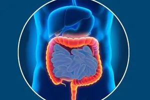 باحثون يكتشفون مؤشراً مبكراً لالتهاب الأمعاء