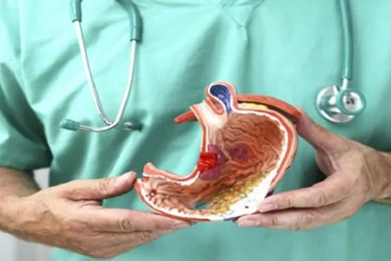 أعراض صامتة قد تكشف سرطانات الجهاز الهضمي في مراحلها المبكرة